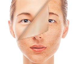 Zeige Details für  BB Glow Ausbildung Bild von  BB Glow Ausbildung